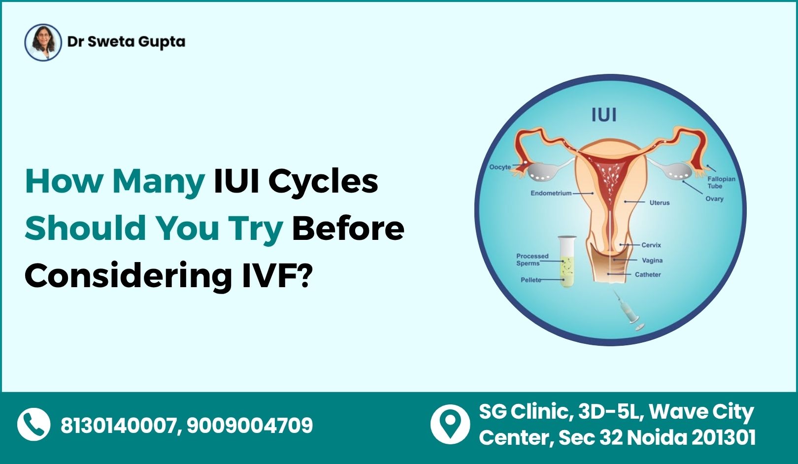 IUI Treatment in Noida