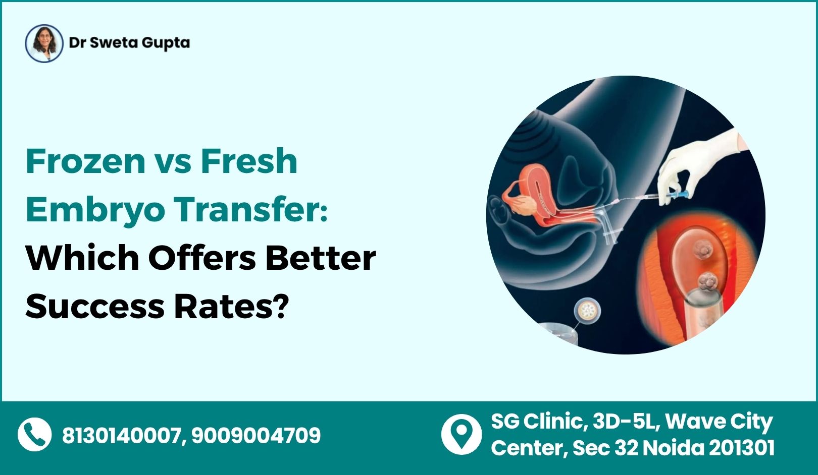 Frozen vs Fresh Embryo Transfer