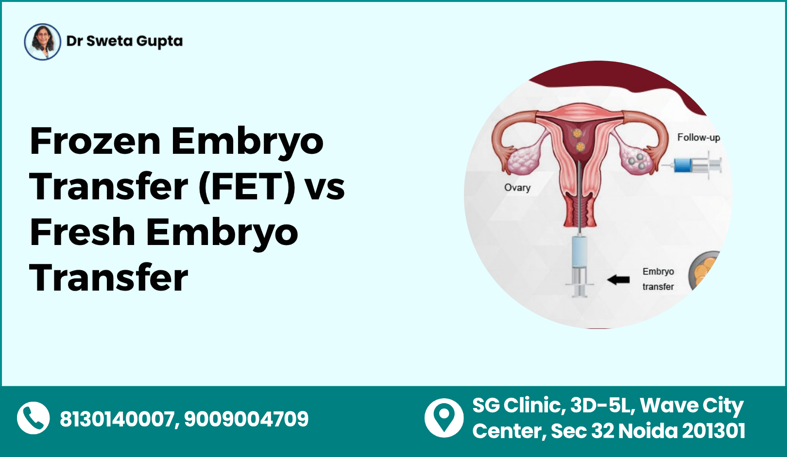 Frozen Embryo Transfer vs Fresh Transfer