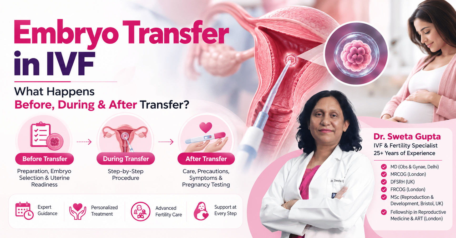 Embryo transfer in IVF procedure – Dr. Sweta Gupta fertility specialist in Noida